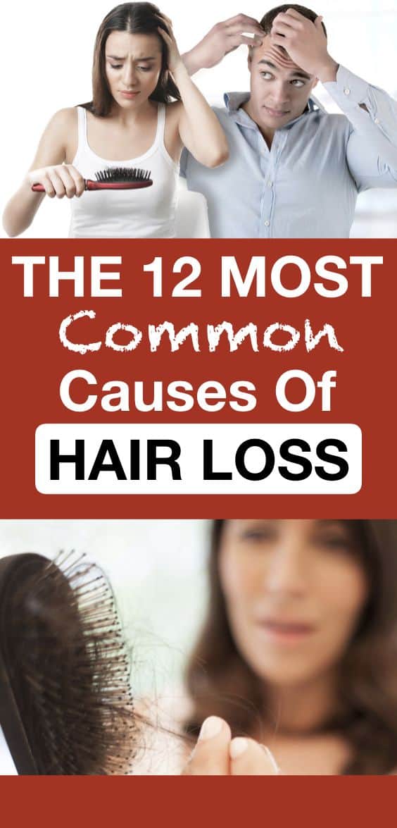 12 Common Causes Of Hair Loss
