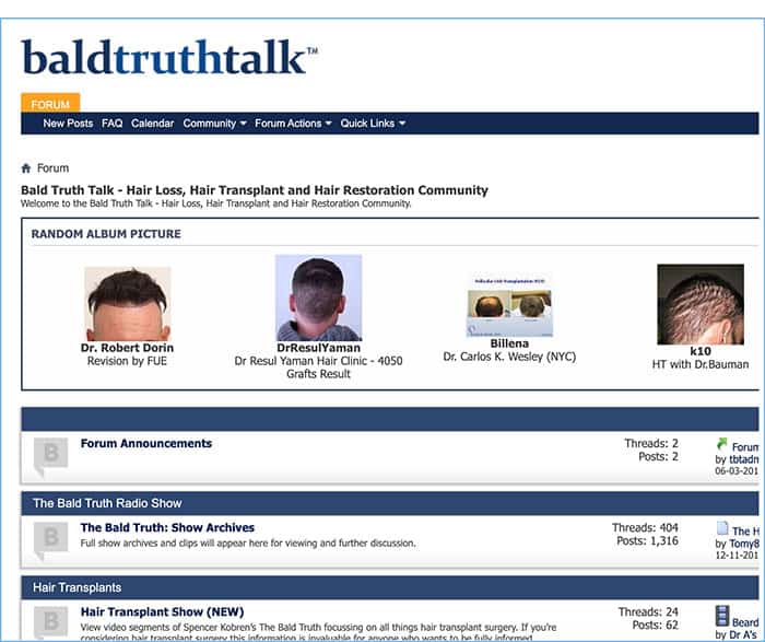Bald Truth Talk Hair Loss Forum